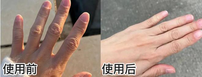 丑！后来发现是小丑竟然是我的手ag九游会登录一直以为是首饰太(图3)