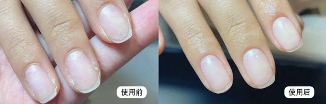 丑！后来发现是小丑竟然是我的手ag九游会登录一直以为是首饰太(图7)